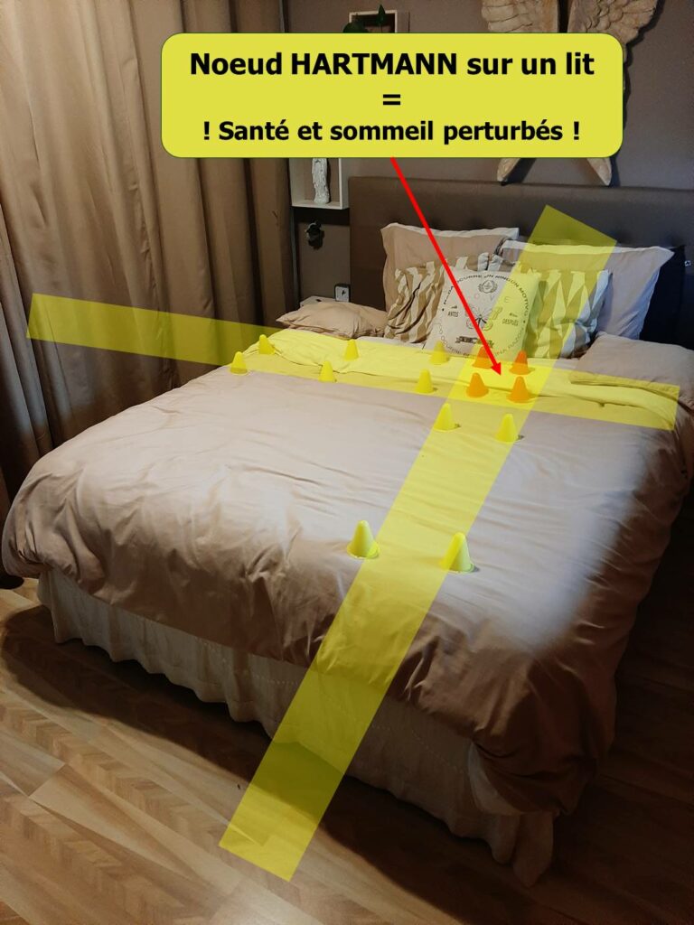 Réseau Hartmann sur un lit